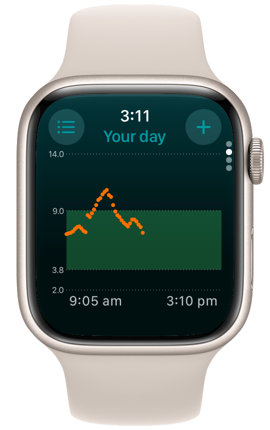 Screenshot showing the new today data chart on the Apple Watch
